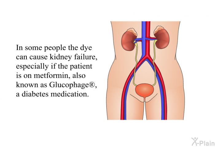 In some people the dye can cause kidney failure, especially if the patient is on metformin, also known as Glucophage<SUP> </SUP>, a diabetes medication.