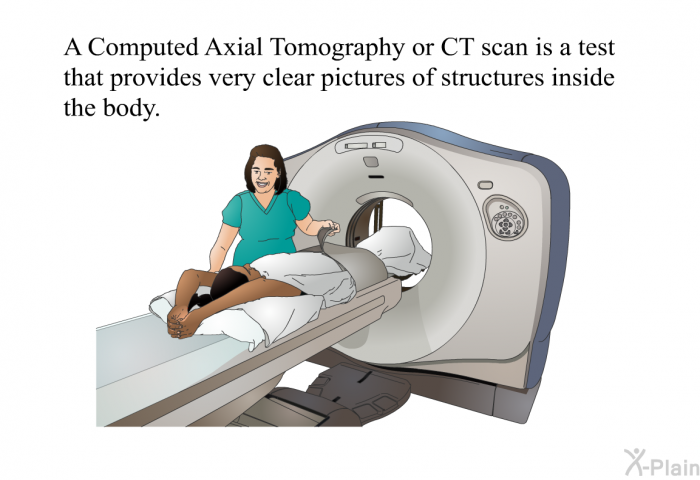 A Computed Axial Tomography or CT scan is a test that provides very clear pictures of structures inside the body.