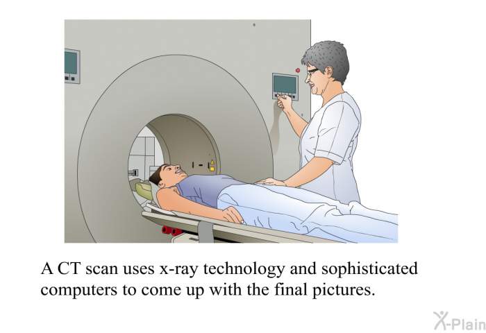 A CT scan uses x-ray technology and sophisticated computers to come up with the final pictures.