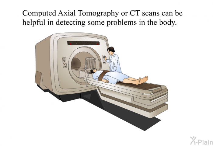 Computed Axial Tomography or CT scans can be helpful in detecting some problems in the body.