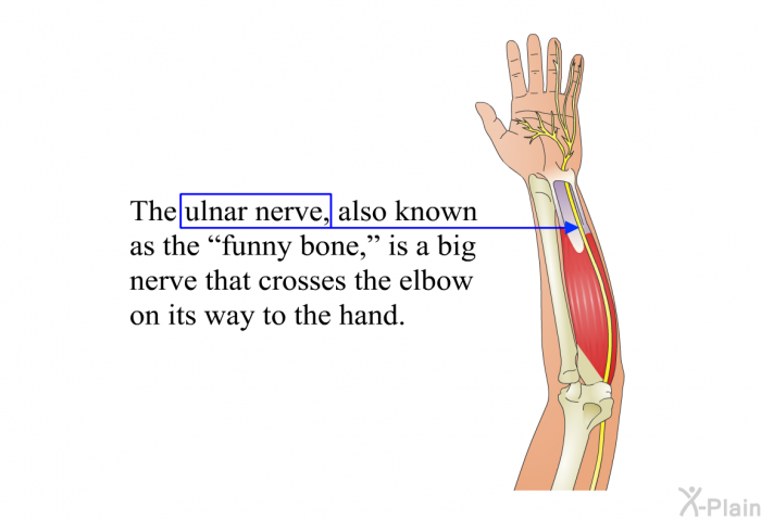 The ulnar nerve, also known as the “funny bone,” is a big nerve that crosses the elbow on its way to the hand.