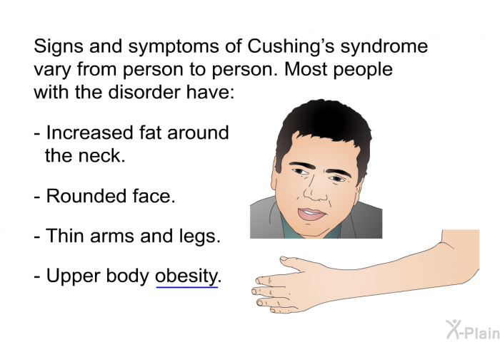 Signs and symptoms of Cushing’s syndrome vary from person to person. Most people with the disorder have:  Increased fat around the neck. Rounded face. Thin arms and legs. Upper body obesity.