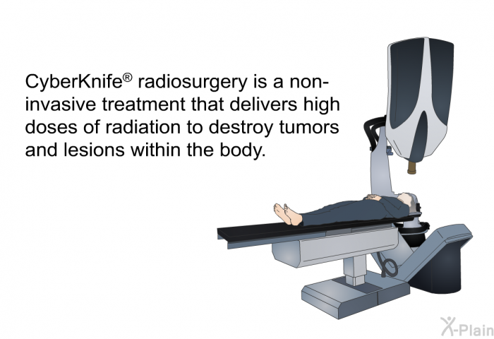 CyberKnife  radiosurgery is a non-invasive treatment that delivers high doses of radiation to destroy tumors and lesions within the body.