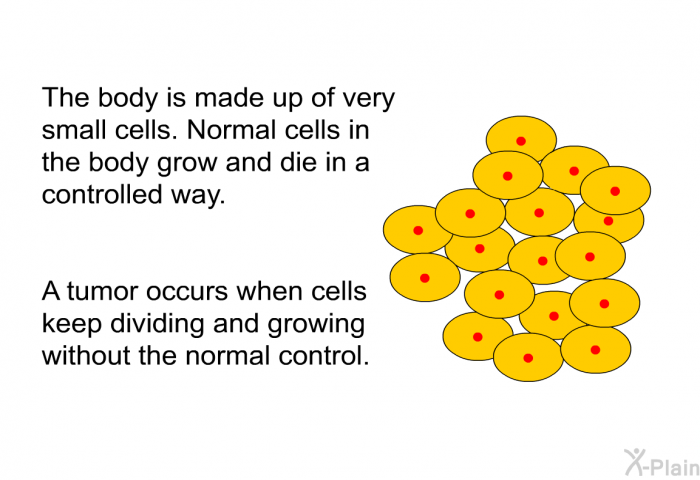 The body is made up of very small cells. Normal cells in the body grow and die in a controlled way. A tumor occurs when cells keep dividing and growing without the normal control.