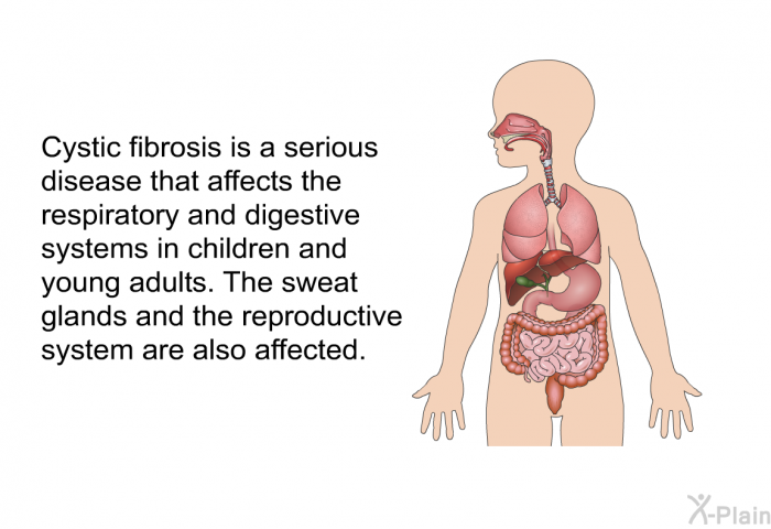 Cystic fibrosis is a serious disease that affects the respiratory and digestive systems in children and young adults. The sweat glands and the reproductive system are also affected.