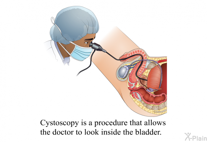 Cystoscopy is a procedure that allows the doctor to look inside the bladder.
