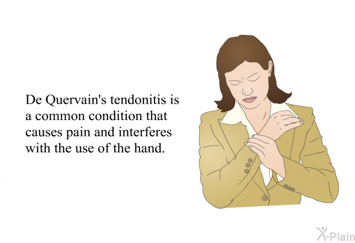 De Quervain's tendonitis is a common condition that causes pain and interferes with the use of the hand.