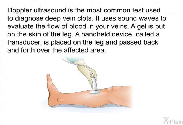 Doppler ultrasound is the most common test used to diagnose deep vein clots. It<B> </B>uses sound waves to evaluate the flow of blood in your veins. A gel is put on the skin of the leg. A handheld device, called a transducer, is placed on the leg and passed back and forth over the affected area.