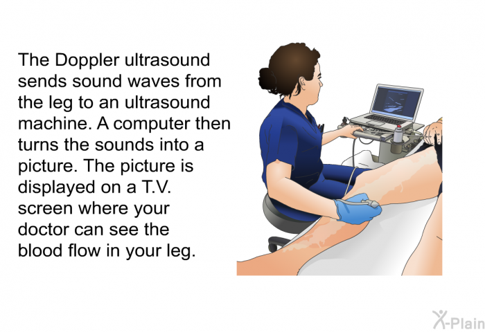 The Doppler ultrasound sends sound waves from the leg to an ultrasound machine. A computer then turns the sounds into a picture. The picture is displayed on a T.V. screen where your doctor can see the blood flow in your leg.