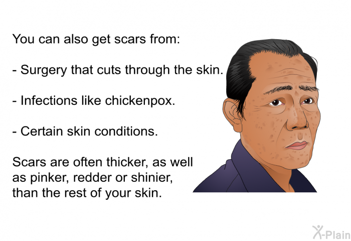 You can also get scars from:  Surgery that cuts through the skin. Infections like chickenpox. Certain skin conditions.  
 Scars are often thicker, as well as pinker, redder or shinier, than the rest of your skin.