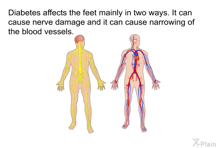Diabetes affects the feet mainly in two ways. It can cause nerve damage and it can cause narrowing of the blood vessels.