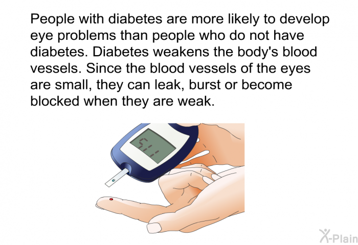 People with diabetes are more likely to develop eye problems than people who do not have diabetes. Diabetes weakens the body's blood vessels. Since the blood vessels of the eyes are small, they can leak, burst or become blocked when they are weak.