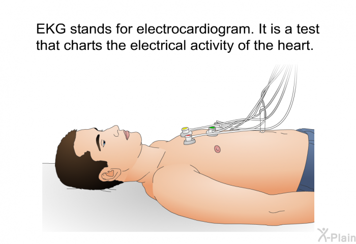 EKG stands for electrocardiogram. It is a test that charts the electrical activity of the heart.