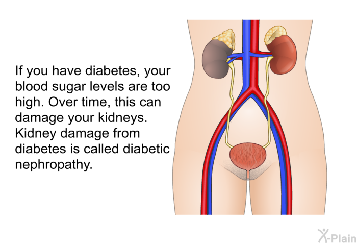 If you have diabetes, your blood sugar levels are too high. Over time, this can damage your kidneys. Kidney damage from diabetes is called diabetic nephropathy.