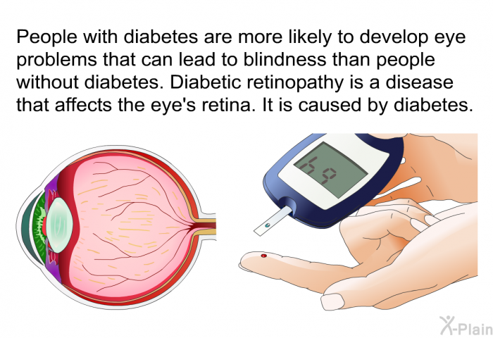 People with diabetes are more likely to develop eye problems that can lead to blindness than people without diabetes. Diabetic retinopathy is a disease that affects the eye's retina. It is caused by diabetes.