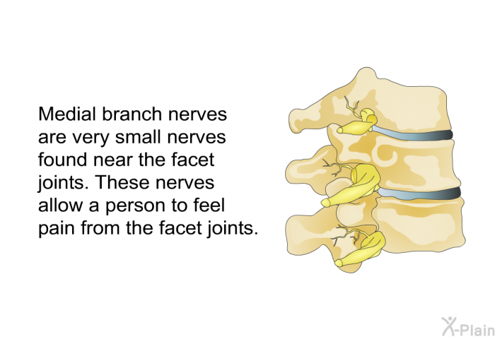 Medial branch nerves are very small nerves found near the facet joints. These nerves allow a person to feel pain from the facet joints.