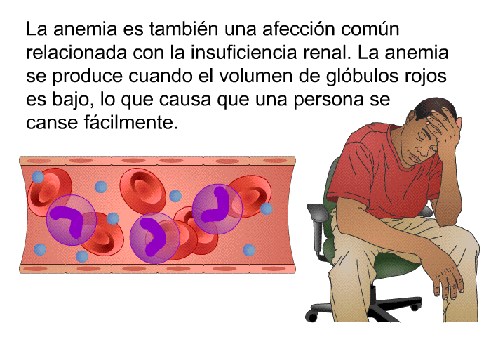 Anemia is also a common condition related to kidney failure. Anemia is when the volume of red blood cells is low, causing a person to tire easily.