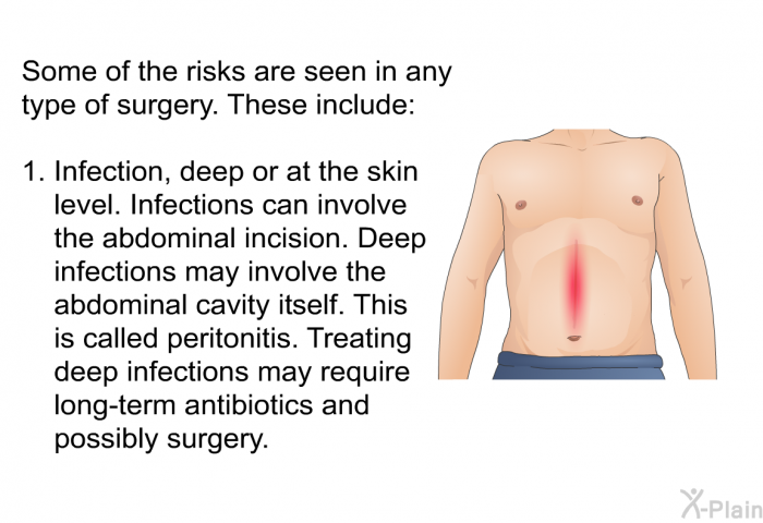 Some of the risks are seen in any type of surgery. These include:  Infection, deep or at the skin level. Infections can involve the abdominal incision. Deep infections may involve the abdominal cavity itself. This is called peritonitis. Treating deep infections may require long-term antibiotics and possibly surgery.
