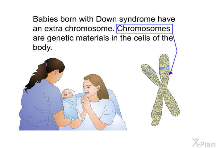Babies born with Down syndrome have an extra chromosome. Chromosomes are genetic materials in the cells of the body.