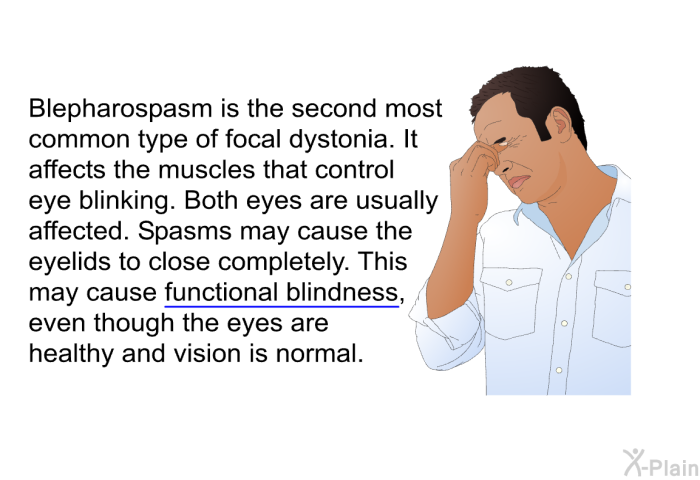 Blepharospasm is the second most common type of focal dystonia. It affects the muscles that control eye blinking. Both eyes are usually affected. Spasms may cause the eyelids to close completely. This may cause functional blindness, even though the eyes are healthy and vision is normal.