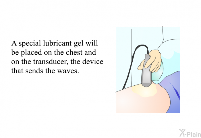 A special lubricant gel will be placed on the chest and on the transducer, the device that sends the waves.