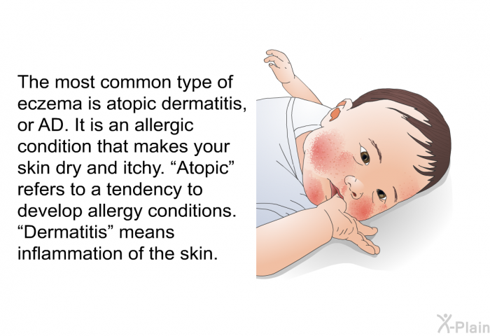 The most common type of eczema is atopic dermatitis, or AD. It is an allergic condition that makes your skin dry and itchy. “Atopic” refers to a tendency to develop allergy conditions. “Dermatitis” means inflammation of the skin.
