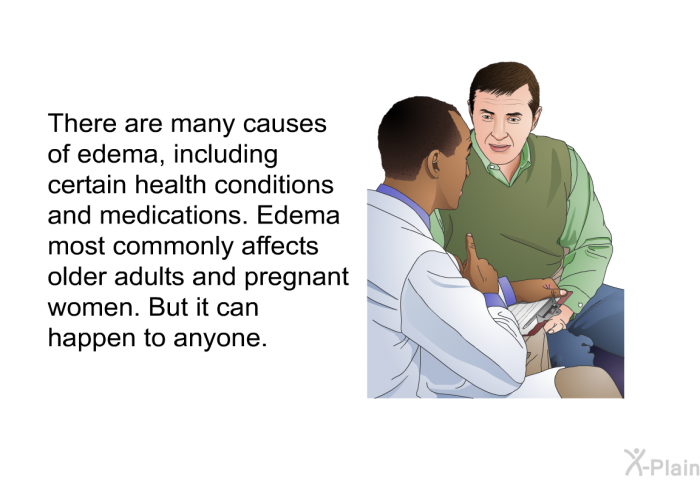 There are many causes of edema, including certain health conditions and medications. Edema most commonly affects older adults and pregnant women. But it can happen to anyone.