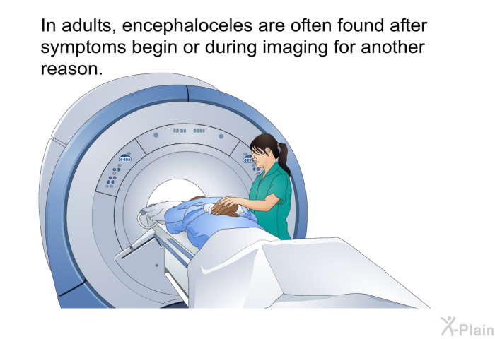 In adults, encephaloceles are often found after symptoms begin or during imaging for another reason.