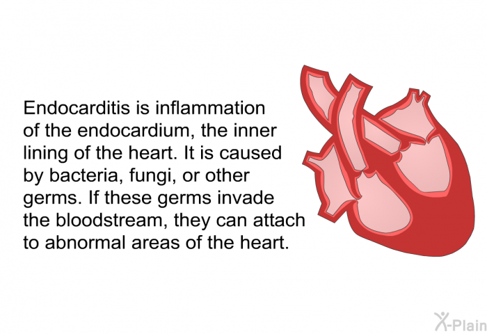 Endocarditis is inflammation of the endocardium, the inner lining of the heart. It is caused by bacteria, fungi, or other germs. If these germs invade the bloodstream, they can attach to abnormal areas of the heart.