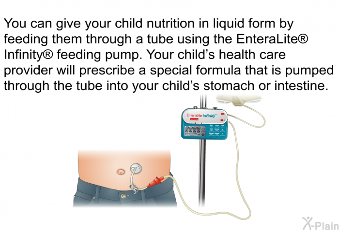 You can give your child nutrition in liquid form by feeding them through a tube using the EnteraLite  Infinity  feeding pump. Your child's health care provider will prescribe a special formula that is pumped through the tube into your child's stomach or intestine.