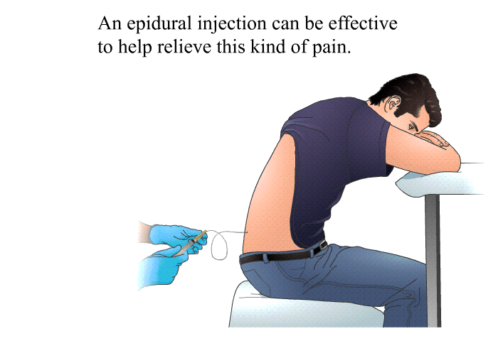 An epidural injection can be effective to help relieve this kind of pain.