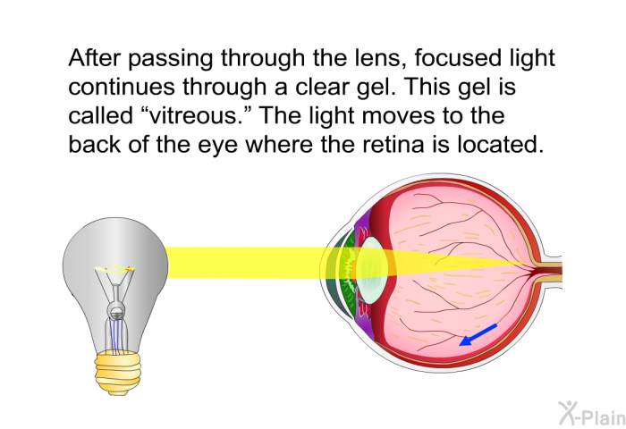 After passing through the lens, focused light continues through a clear gel. This gel is called “vitreous.” The light moves to the back of the eye where the retina is located.