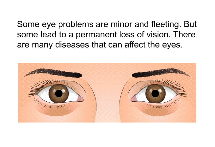 Some eye problems are minor and fleeting. But some lead to a permanent loss of vision. There are many diseases that can affect the eyes.