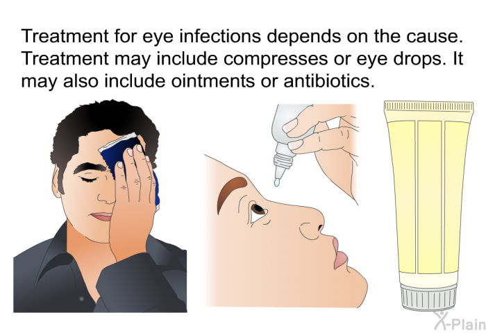Treatment for eye infections depends on the cause. Treatment may include compresses or eye drops. It may also include ointments or antibiotics.