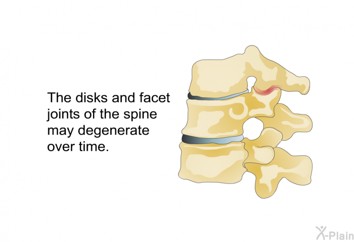 The disks and facet joints of the spine may degenerate over time.