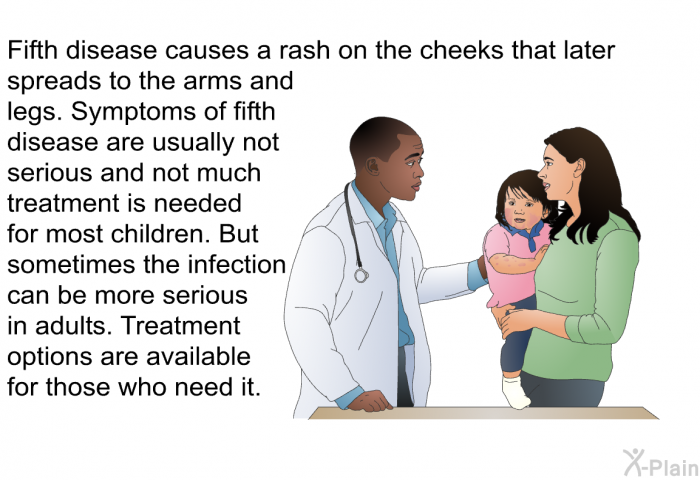 Fifth disease causes a rash on the cheeks that later spreads to the arms and legs. Symptoms of fifth disease are usually not serious and not much treatment is needed for most children. But sometimes the infection can be more serious in adults. Treatment options are available for those who need it.