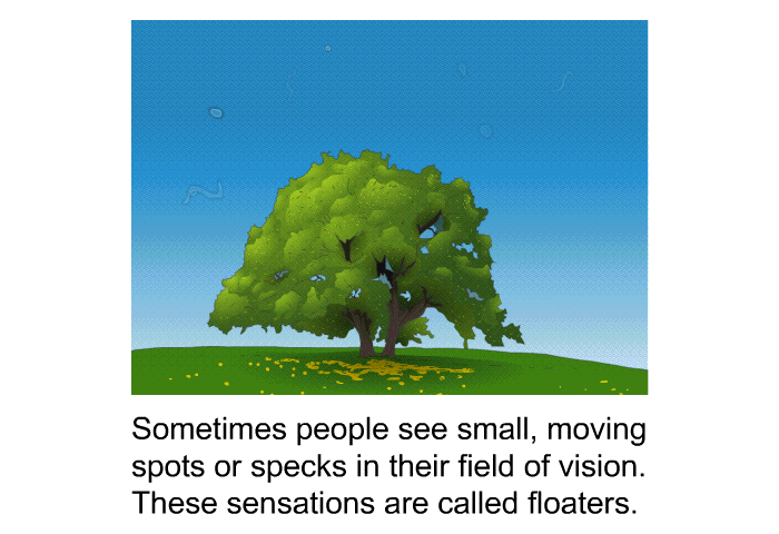 Sometimes people see small, moving spots or specks in their field of vision. These sensations are called floaters.