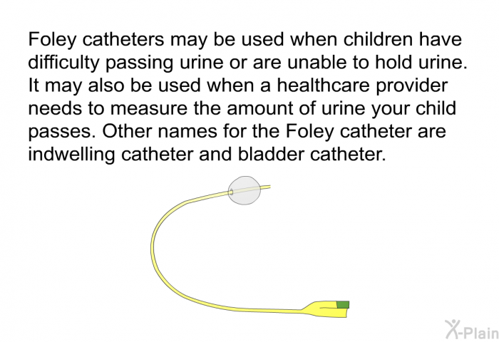 Foley catheters may be used when children have difficulty passing urine or are unable to hold urine. It may also be used when a healthcare provider needs to measure the amount of urine your child passes. Other names for the Foley catheter are indwelling catheter and bladder catheter.