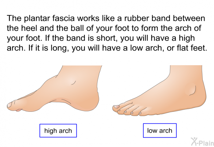 The plantar fascia works like a rubber band between the heel and the ball of your foot to form the arch of your foot. If the band is short, you will have a high arch. If it is long, you will have a low arch, or flat feet.