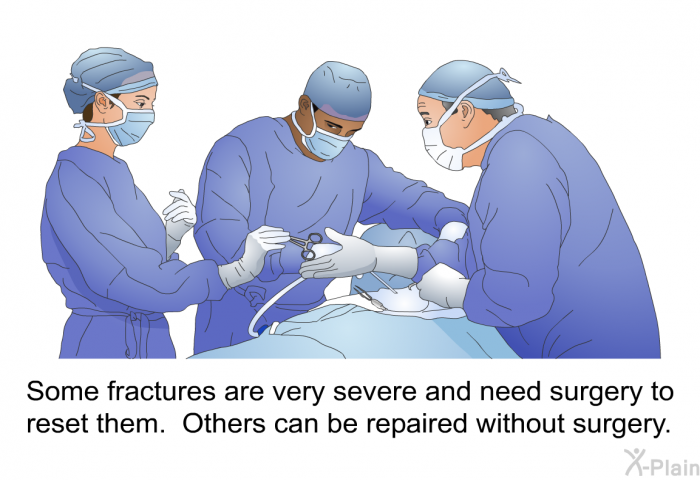 Some fractures are very severe and need surgery to reset them. Others can be repaired without surgery.