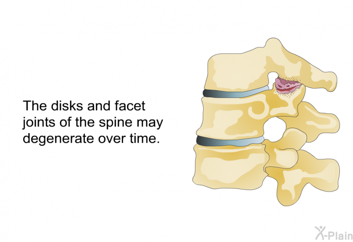 The disks and facet joints of the spine may degenerate over time.