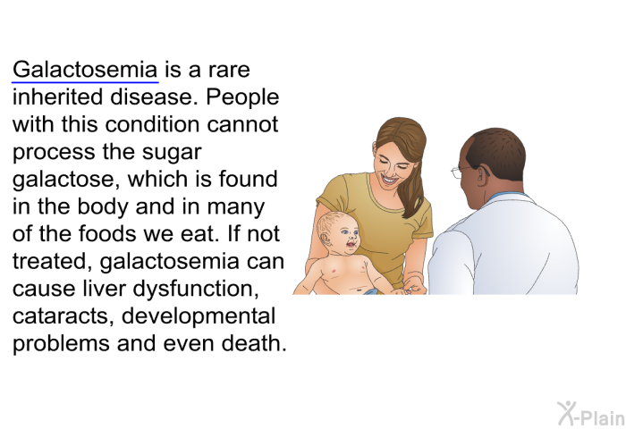 Galactosemia is a rare inherited disease. People with this condition cannot process the sugar galactose, which is found in the body and in many of the foods we eat. If not treated, galactosemia can cause liver dysfunction, cataracts, developmental problems and even death.