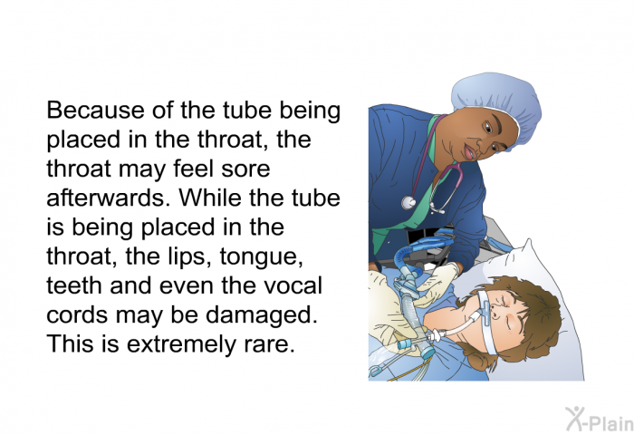 Because of the tube being placed in the throat, the throat may feel sore afterwards. While the tube is being placed in the throat, the lips, tongue, teeth and even the vocal cords may be damaged. This is extremely rare.