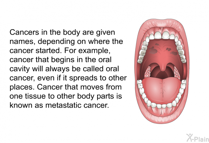 Cancers in the body are given names, depending on where the cancer started. For example, cancer that begins in the oral cavity will always be called oral cancer, even if it spreads to other places. Cancer that moves from one tissue to other body parts is known as metastatic cancer.