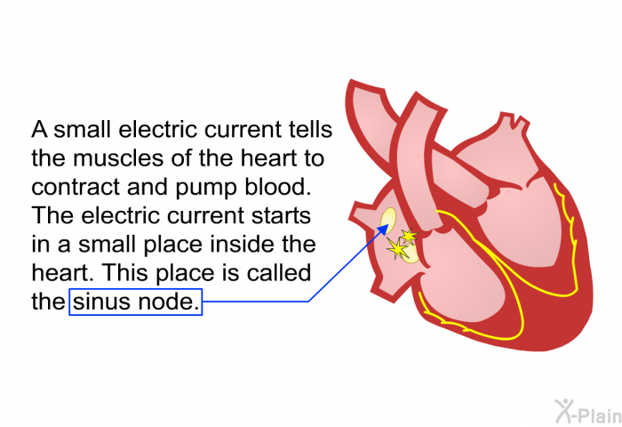 A small electric current tells the muscles of the heart to contract and pump blood. The electric current starts in a small place inside the heart. This place is called the sinus node.