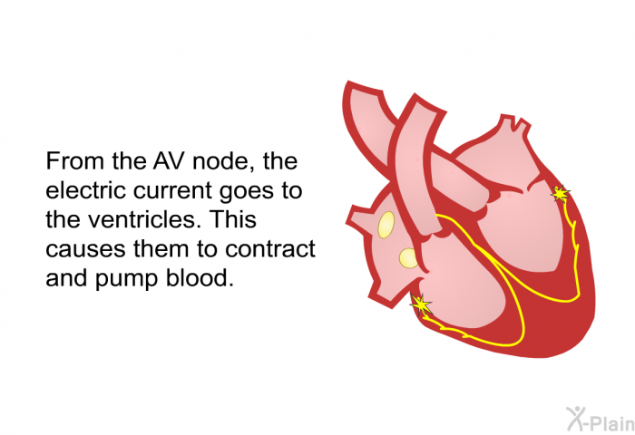 From the AV node, the electric current goes to the ventricles. This causes them to contract and pump blood.