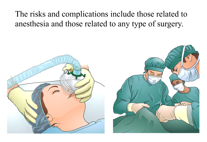 The risks and complications include those related to anesthesia and those related to any type of surgery.