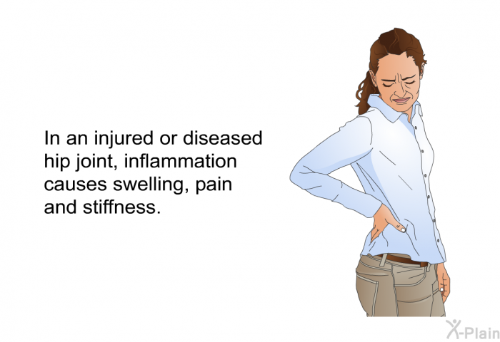 In an injured or diseased hip joint, inflammation causes swelling, pain and stiffness.