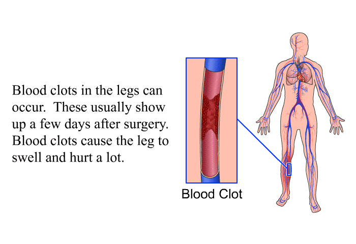Blood clots in the legs can occur. These usually show up a few days after surgery. Blood clots cause the leg to swell and hurt a lot.