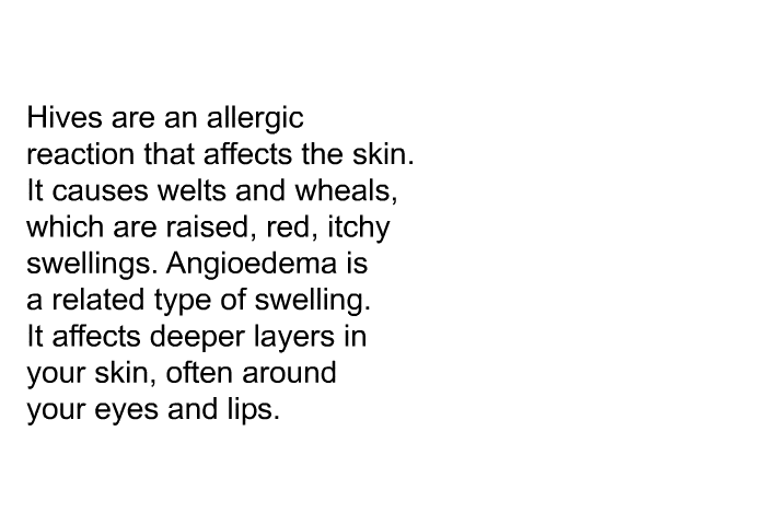 Hives are an allergic reaction that affects the skin. It causes welts and wheals, which are raised, red, itchy swellings. Angioedema is a related type of swelling. It affects deeper layers in your skin, often around your eyes and lips.